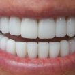 Esztétikai fogászat, fogorvos, fogszabályozás, fogpótlás 22. kerület
